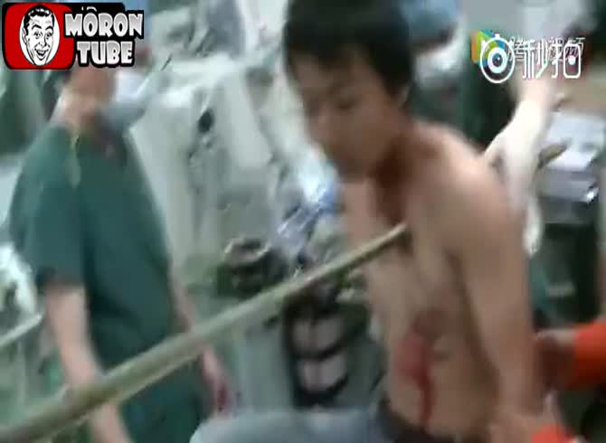 Video :Crazy things are always occurring in China - punctured by a bamboo stick and sent to the hospital